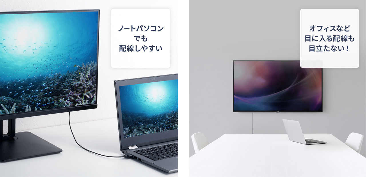 251020_KM-HD20-SS0N_03BcqxyEr0